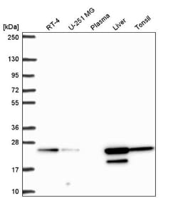 ACOT6 Antibody, Novus Biologicals 0.1mL; Unlabeled:Antibodies, Polyclonal